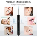 7MD Ear Cleaner Portable Visual Wifi Ear Wax Cleaner Endoscope With Rechargeable Battery | MX8 |